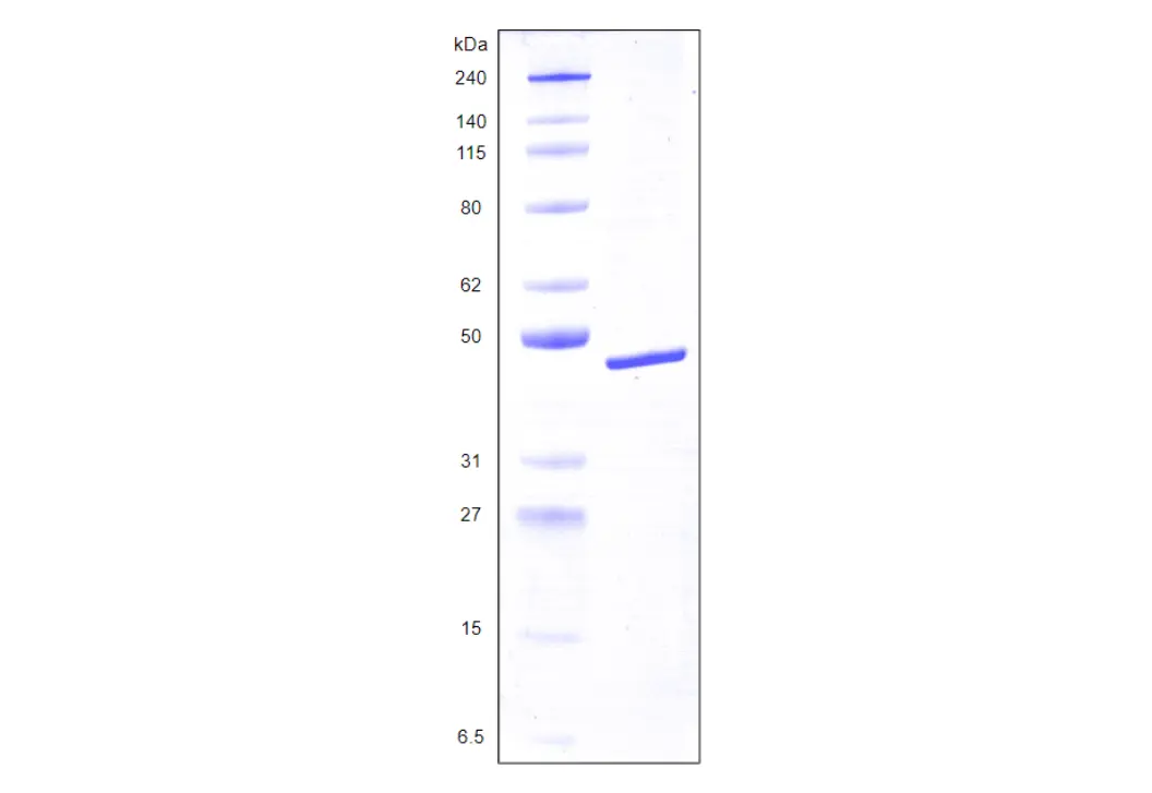[MC04-025] Recombinant Human Galectin 8, variant 2, His Tag (359 a.a.) -25 ug