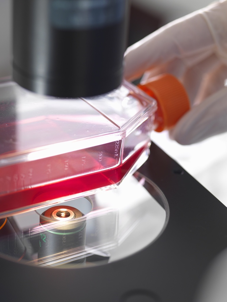 Red Fluorescent Immortalized Human Renal Mesangial Cells