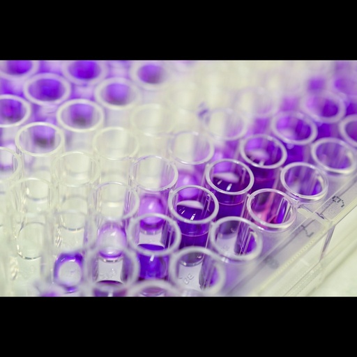 [0964-FE005] Bovine Mycobacterium tuberculosis Anticorps ELISA Kit size: 96 tests
